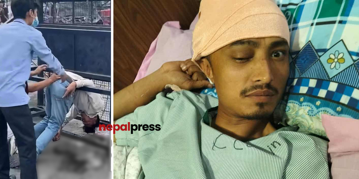 गोली लागेर प्रहरी ब्यारिकेडमा ढलेका दीपेन्द्र, अस्पतालको बेडमा पनि देशकै सुर्ता