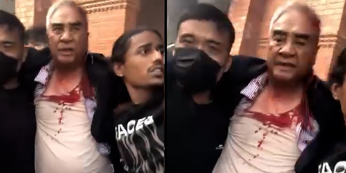 आन्दोलनकारीको आक्रमणमा देउवा दम्पत्ती घाइते,आगजनी भएकै घरभित्र थिए